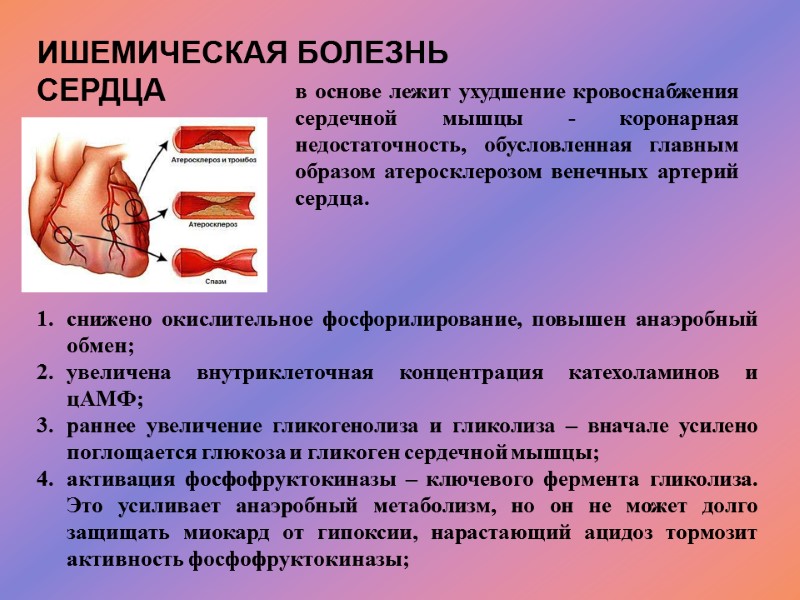 ИШЕМИЧЕСКАЯ БОЛЕЗНЬ СЕРДЦА в основе лежит ухудшение кровоснабжения сердечной мышцы - коронарная недостаточность, обусловленная